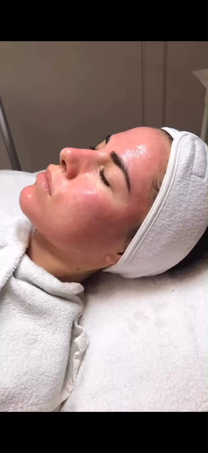 Frischer Haut-Glow direkt nach einer Gesichtsbehandlung bei Beauty by Alina Blum Baden-Baden